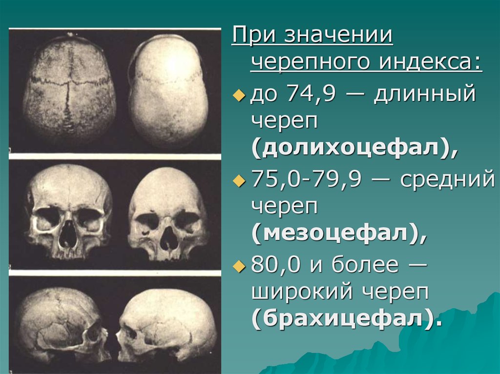 Формы черепа. Брахицефал мезоцефал.