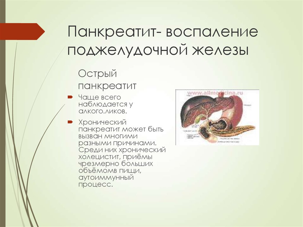 Поджелудочная железа воспаление