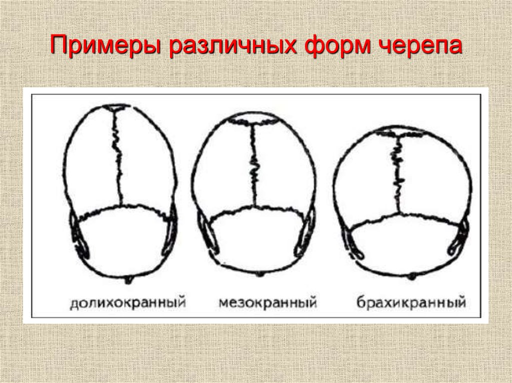 Варианты формы черепа. Деформация черепа долихоцефалия. Формы черепа человека. Долихокранная форма черепа. Нормальная форма черепа человека.
