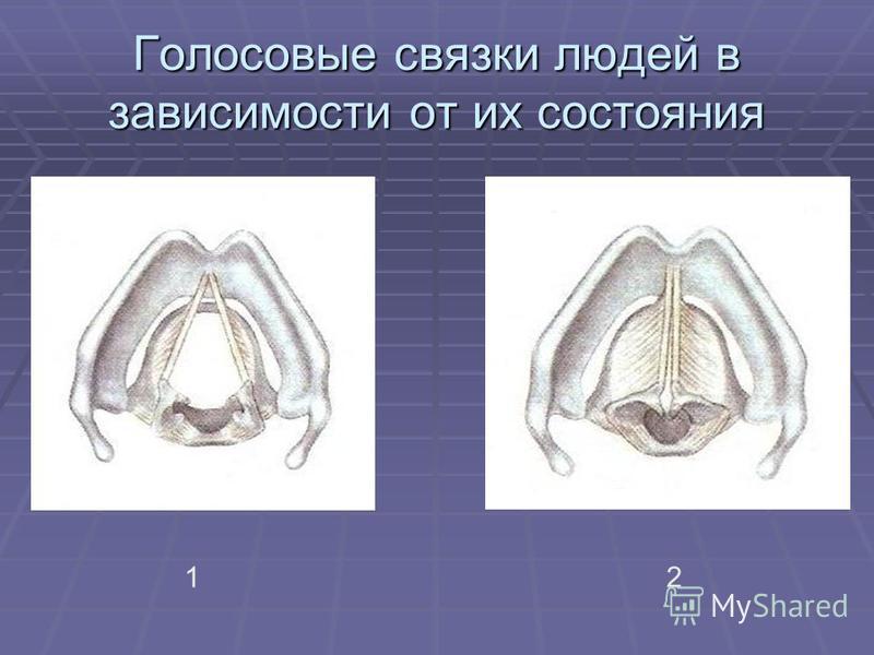 Молчание голосовые связки