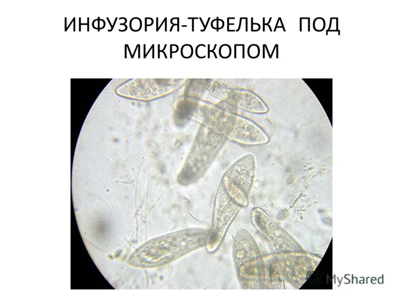 Строение инфузории туфельки под микроскопом