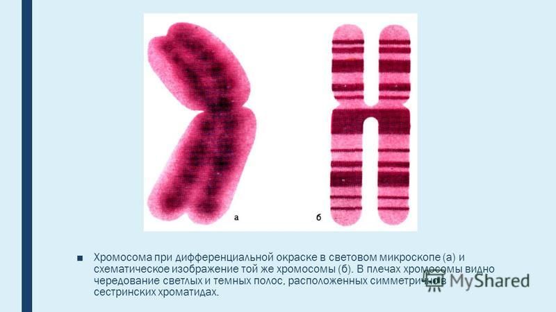 Изменение окраски хромосом. Хромосома. Нарушение хромосом. Хромосомы человека. Дифференциальная окраска хромосом.