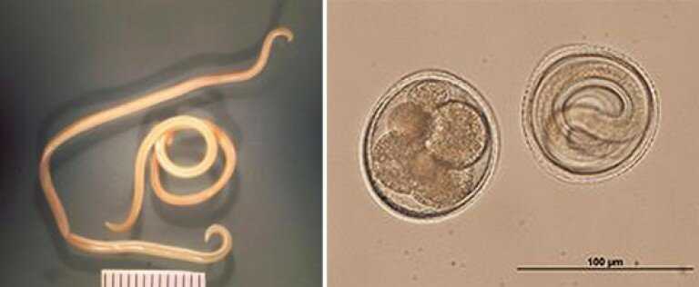 Токсокароз у взрослых. Личинки токсокара Канис. Токсокара паразитология.