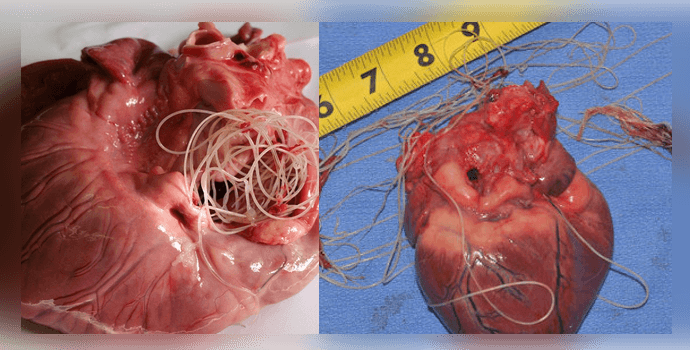 паразиты в сердце человека