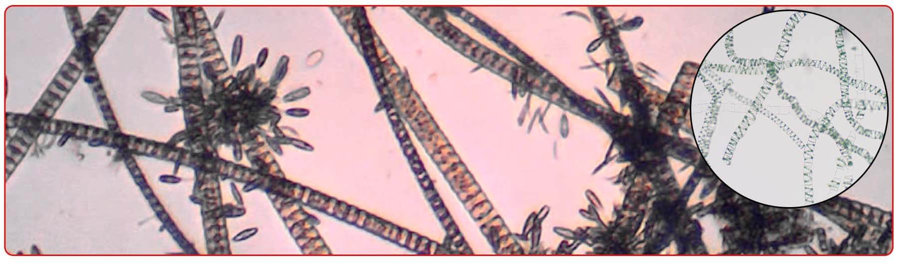 Аквариумные водоросли под микроскопом