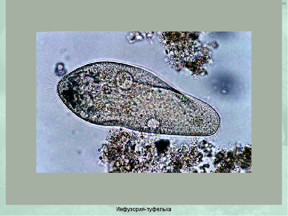 Способ инфузории туфельки. Инфузория туфелька макронуклеус. Инфузория туфелька клетка. Инфузория туфелька протоплазма. Одноклеточные организмы инфузория туфелька.