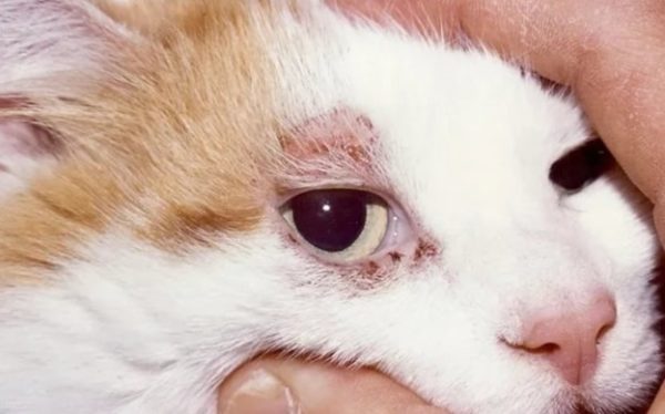 Демодекозные очки.