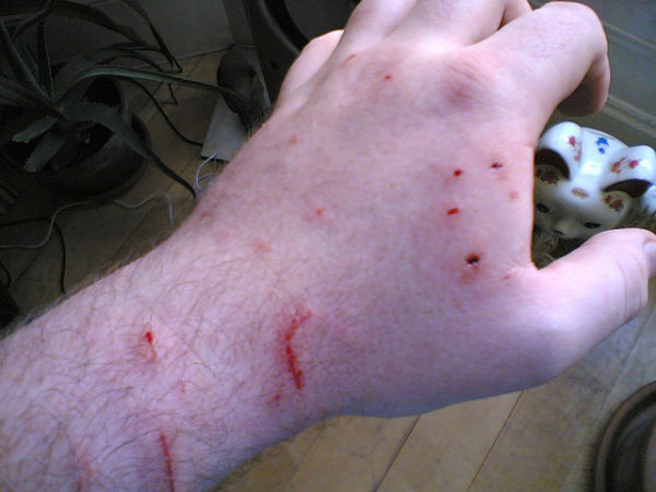 Нужно беречь руки от укусов кошки, поскольку они долго заживают
