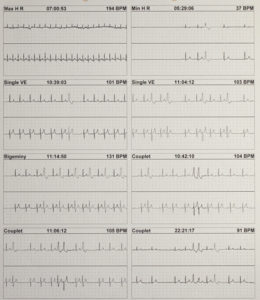 Teaching EKG